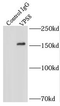 VPS8 Rabbit Polyclonal Antibody