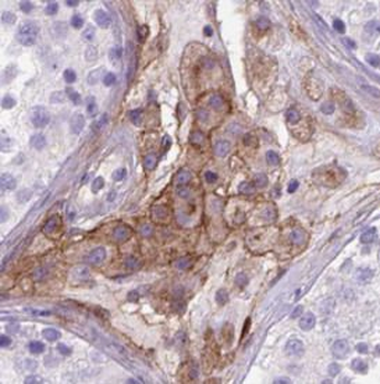 VSIG1 Rabbit Polyclonal Antibody