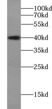 VSTM1 Antibody
