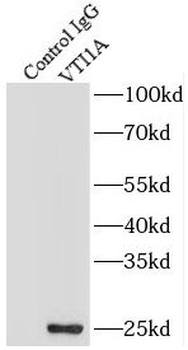 VTI1A Rabbit Polyclonal Antibody