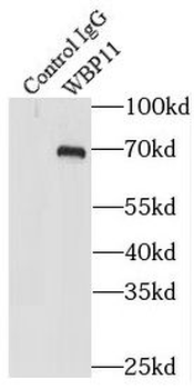 WBP11 Rabbit Polyclonal Antibody