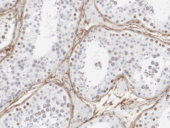 WDR1 Rabbit Polyclonal Antibody