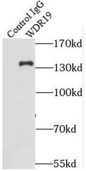 WDR19 Rabbit Polyclonal Antibody