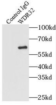 DCAF10 Rabbit Polyclonal Antibody