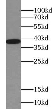 DNAAF10 Rabbit Polyclonal Antibody