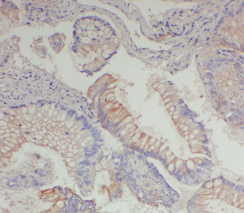 DNAAF10 Rabbit Polyclonal Antibody