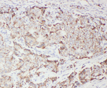 WFDC1 Rabbit Polyclonal Antibody