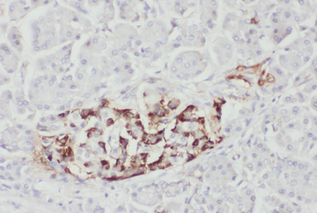 WFS1 Rabbit Polyclonal Antibody