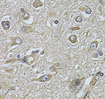 WIPI1 Rabbit Polyclonal Antibody