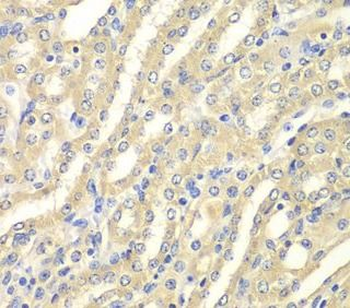 WIPI2 Rabbit Polyclonal Antibody
