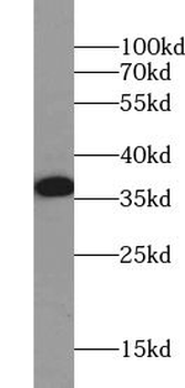 WNT7A Rabbit Polyclonal Antibody