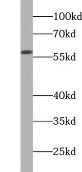 WSB1 Antibody