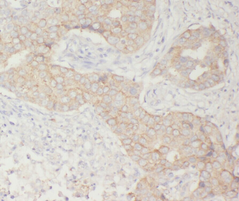 WSB1 Rabbit Polyclonal Antibody