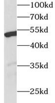 WT1 Antibody