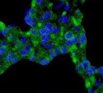 WWC2 Rabbit Polyclonal Antibody