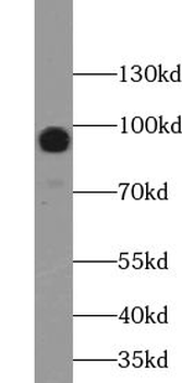 WWP1 Rabbit Polyclonal Antibody