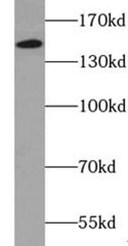 XDH Rabbit Polyclonal Antibody