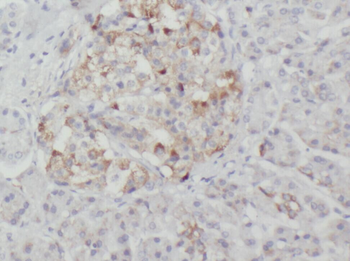 XK Rabbit Polyclonal Antibody