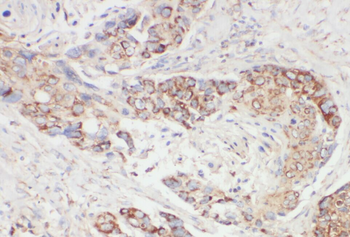 XPNPEP3 Rabbit Polyclonal Antibody