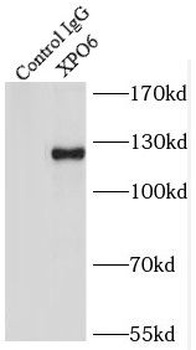 XPO6 Rabbit Polyclonal Antibody