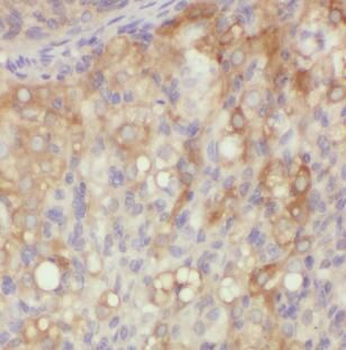 XPO6 Rabbit Polyclonal Antibody
