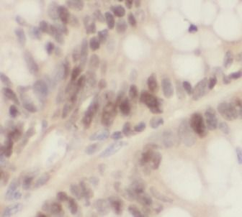 XRCC5 Rabbit Polyclonal Antibody