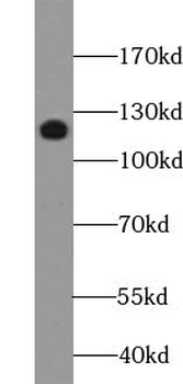 XYLT1 Antibody