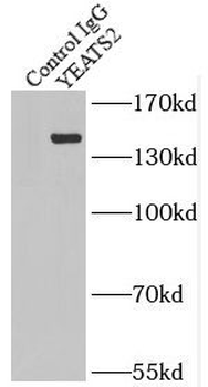 YEATS2 Rabbit Polyclonal Antibody