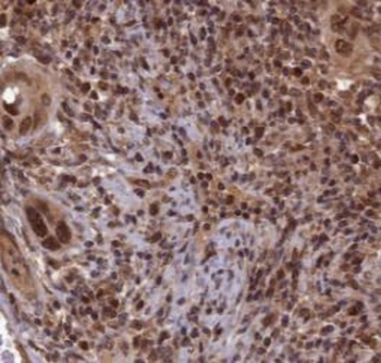 YEATS2 Rabbit Polyclonal Antibody