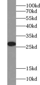 YIPF4 Rabbit Polyclonal Antibody