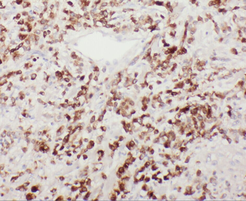 YIPF4 Rabbit Polyclonal Antibody