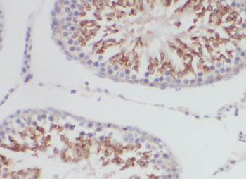 YTHDF2 Rabbit Polyclonal Antibody