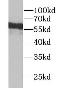 YTHDF3 Rabbit Polyclonal Antibody