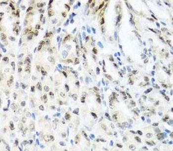 YTHDF3 Rabbit Polyclonal Antibody
