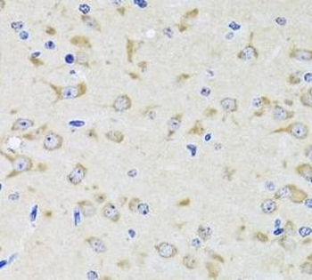 YWHAZ Rabbit Polyclonal Antibody
