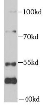 MAP3K20 Antibody
