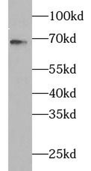 ZAP70 Rabbit Polyclonal Antibody