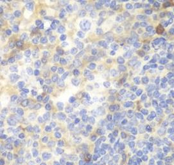 ZAP70 Rabbit Polyclonal Antibody
