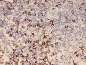 ZAP70 Rabbit Polyclonal Antibody