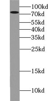 ZBTB20 Antibody