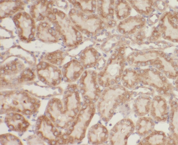 ZBTB20 Rabbit Polyclonal Antibody