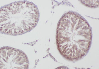 ZBTB38 Rabbit Polyclonal Antibody