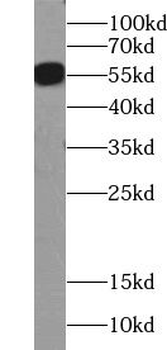 ZBTB8A Rabbit Polyclonal Antibody