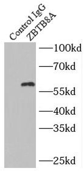 ZBTB8A Rabbit Polyclonal Antibody