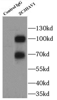 ZC3HAV1 Rabbit Polyclonal Antibody
