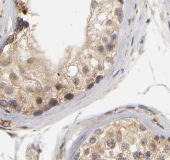 ZC3HAV1 Rabbit Polyclonal Antibody