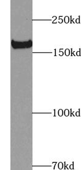 TUT7 Rabbit Polyclonal Antibody