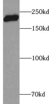 ZEB1 Rabbit Polyclonal Antibody