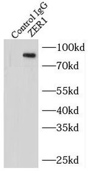 ZER1 Rabbit Polyclonal Antibody