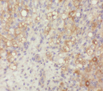 ZER1 Rabbit Polyclonal Antibody